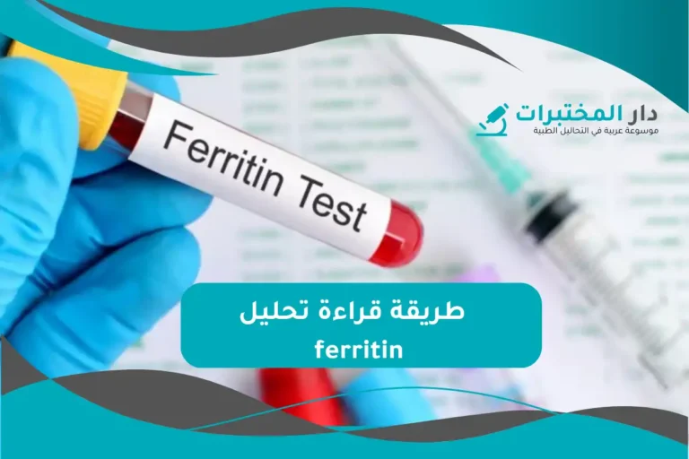 تحليل ferritin