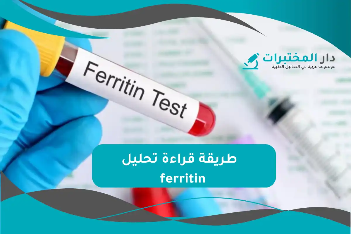 تحليل ferritin
