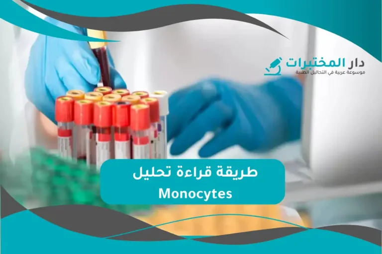 تحليل Monocytes المعدل الطبيعي