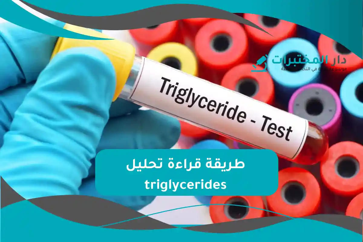 تحليل triglycerides المعدل الطبيعي
