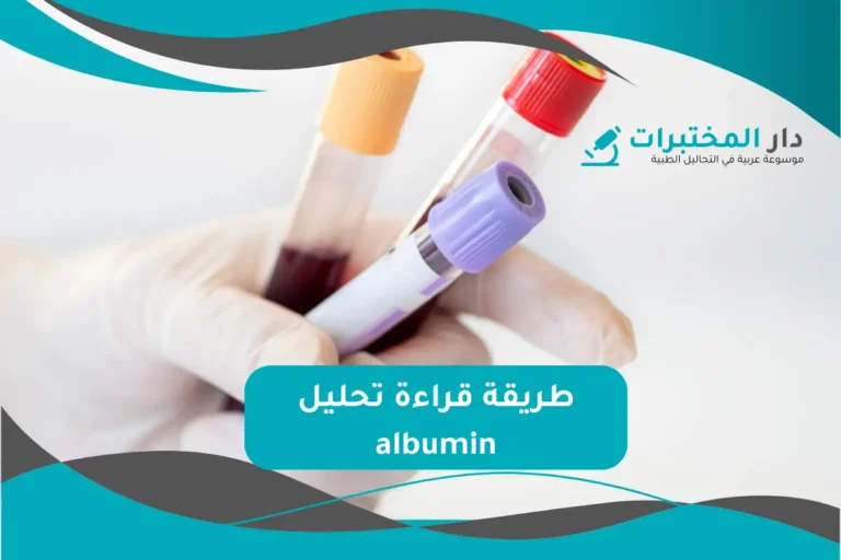 تحليل albumin المعدل الطبيعي نسبة الارتفاع والانخفاض