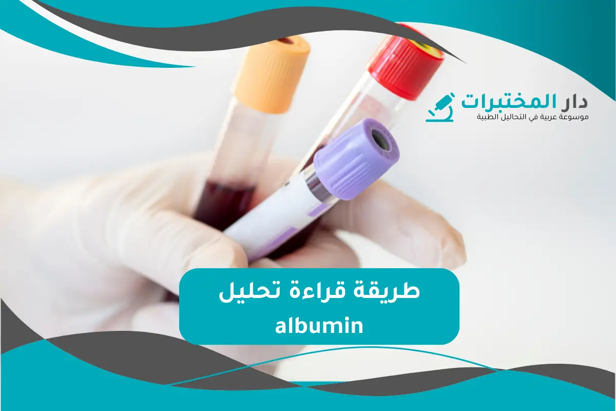 تحليل albumin المعدل الطبيعي نسبة الارتفاع والانخفاض
