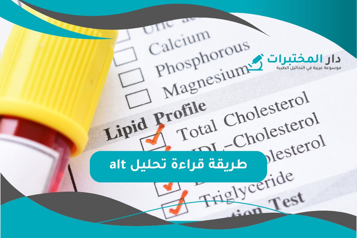 تحليل alt المعدل الطبيعي نسبة الارتفاع والانخفاض