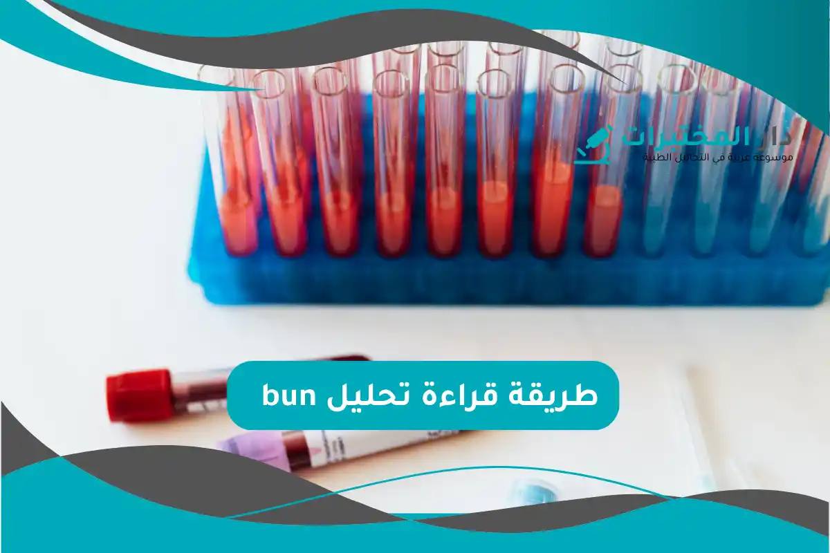 تحليل bun المعدل الطبيعي نسبة الارتفاع والانخفاض