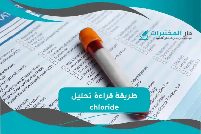 تحليل chloride المعدل الطبيعي نسبة الارتفاع والانخفاض