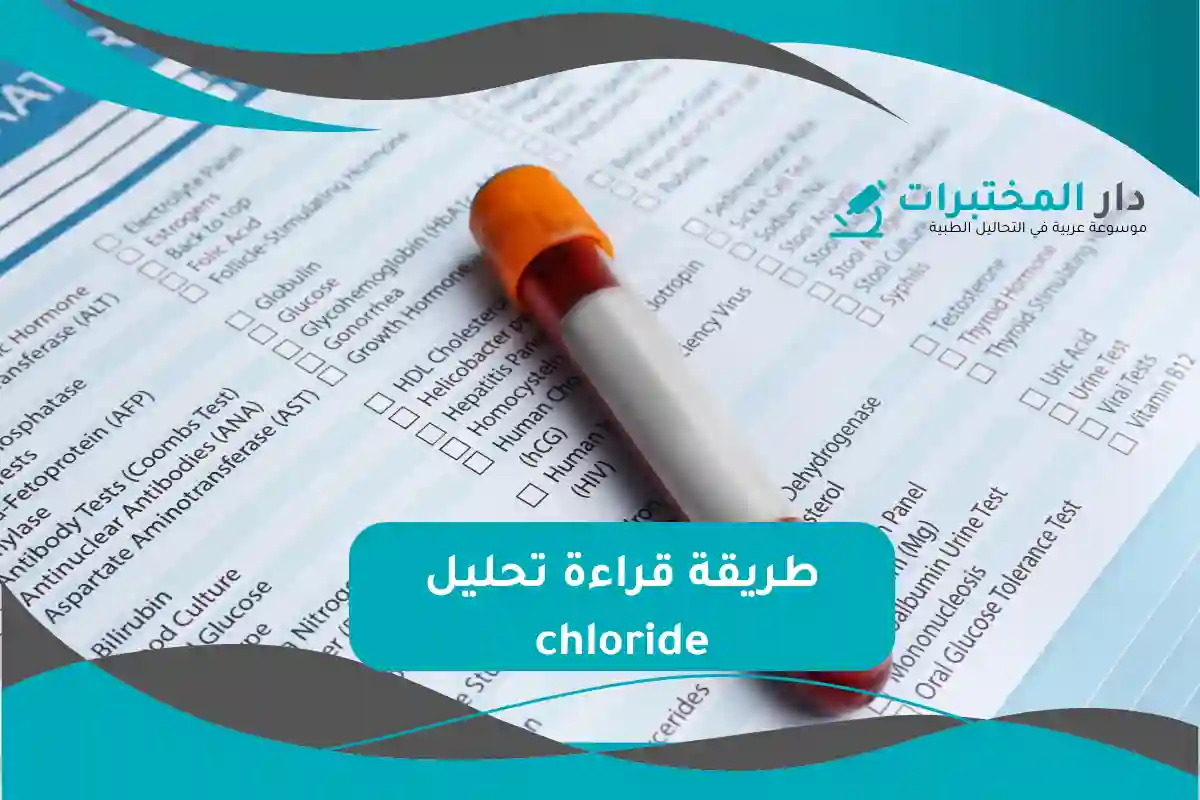 تحليل chloride المعدل الطبيعي نسبة الارتفاع والانخفاض