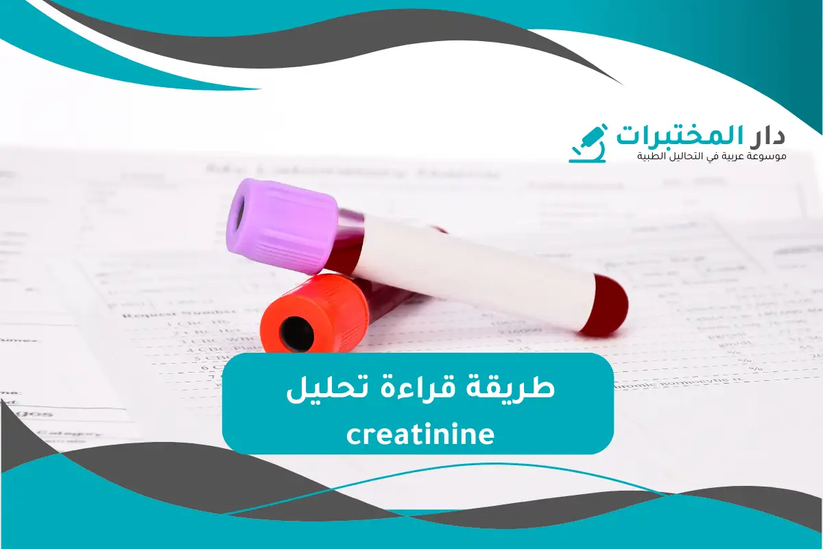 تحليل creatinine المعدل الطبيعي نسبة الارتفاع والانخفاض