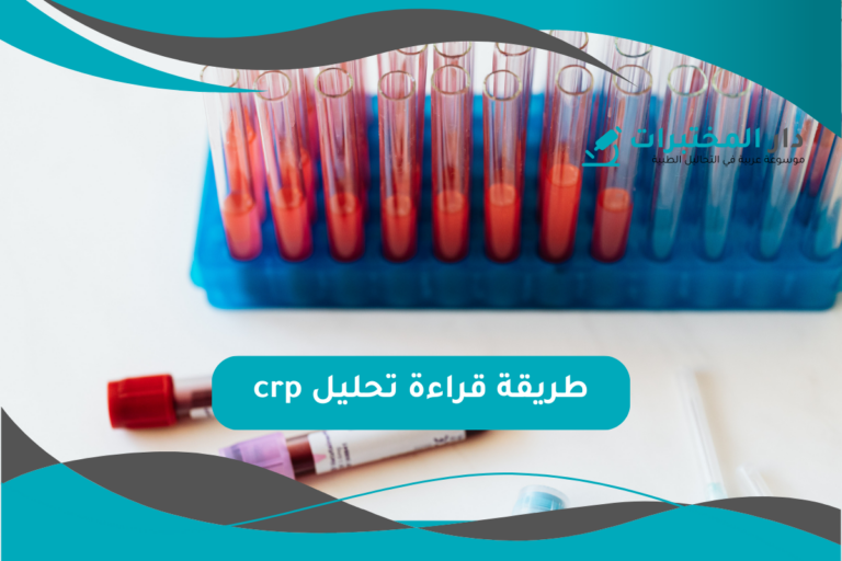 تحليل crp المعدل الطبيعي نسبة الارتفاع والانخفاض