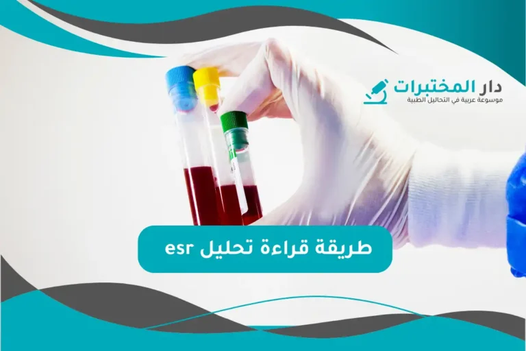 تحليل esr المعدل الطبيعي نسبة الارتفاع والانخفاض