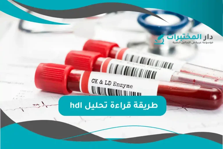 تحليل hdl المعدل الطبيعي نسبة الارتفاع والانخفاض