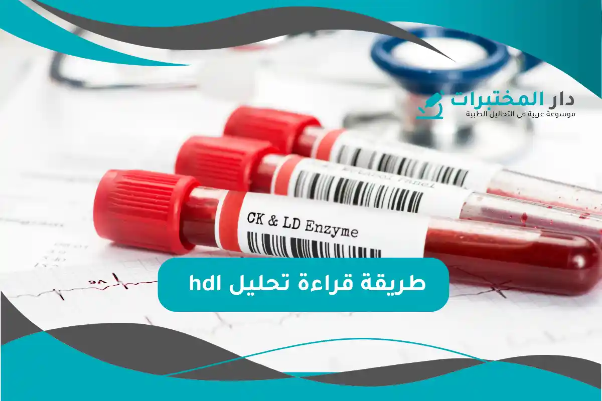 تحليل hdl المعدل الطبيعي نسبة الارتفاع والانخفاض