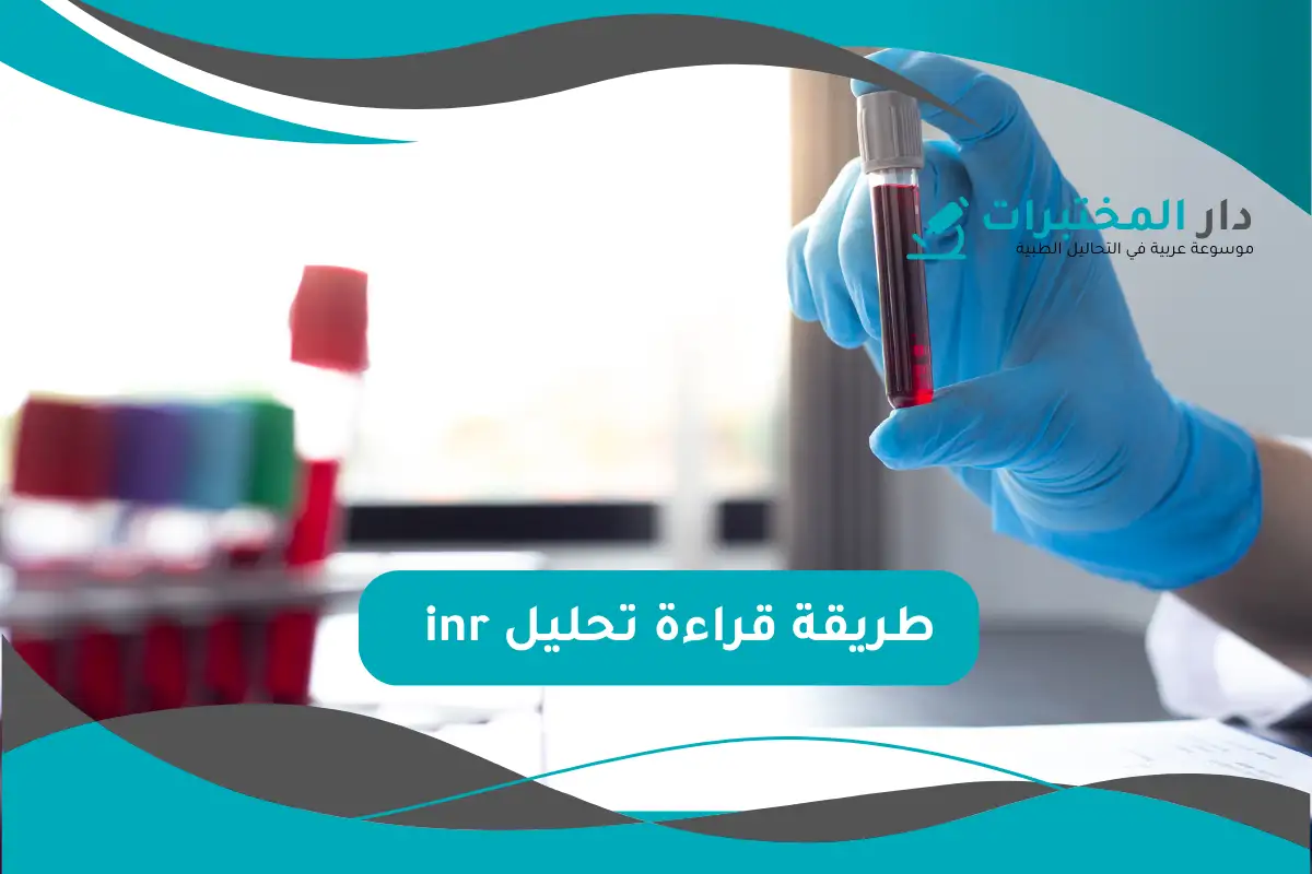 تحليل inr المعدل الطبيعي نسبة الارتفاع والانخفاض