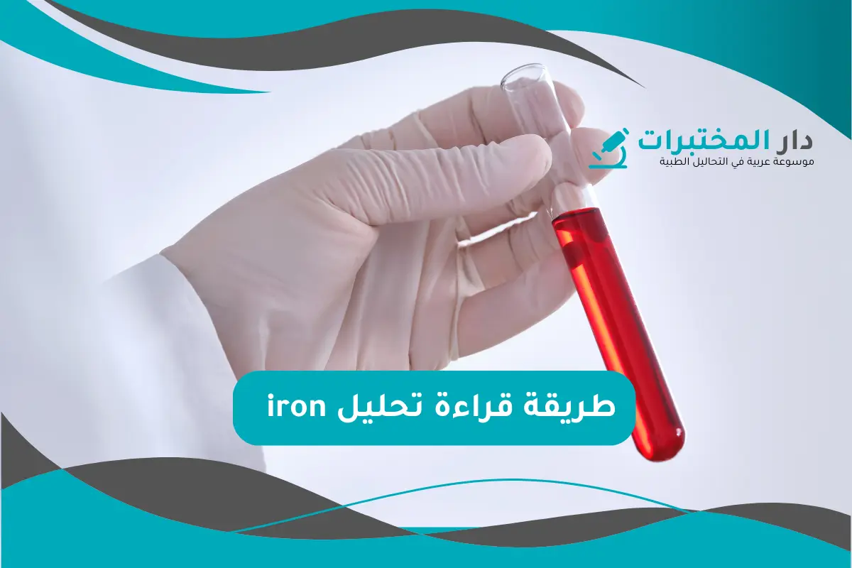 تحليل iron المعدل الطبيعي نسبة الارتفاع والانخفاض