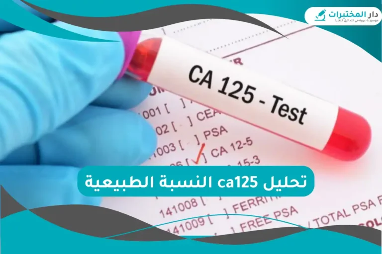 تحليل ca125 النسبة الطبيعية
