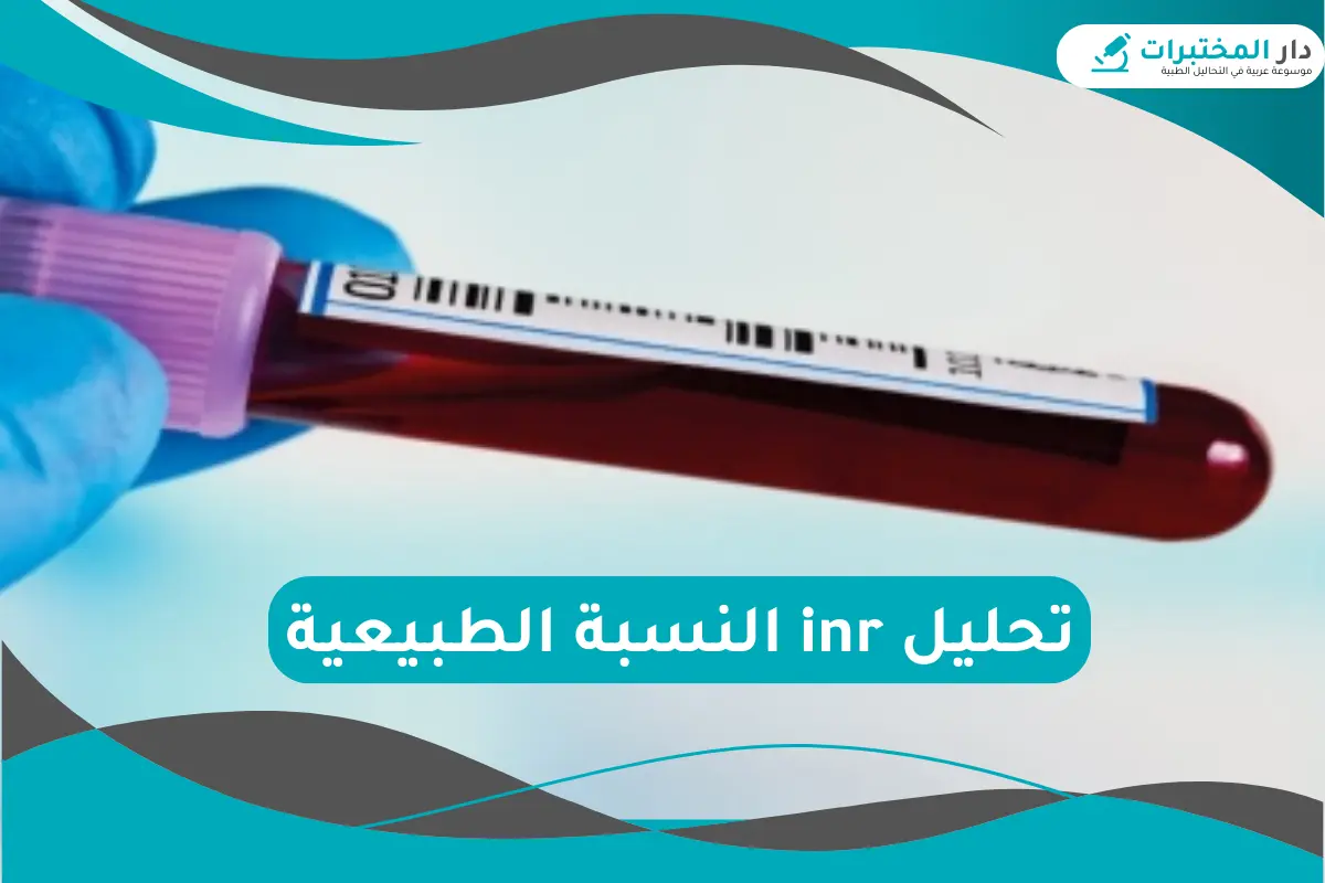 تحليل inr النسبة الطبيعية