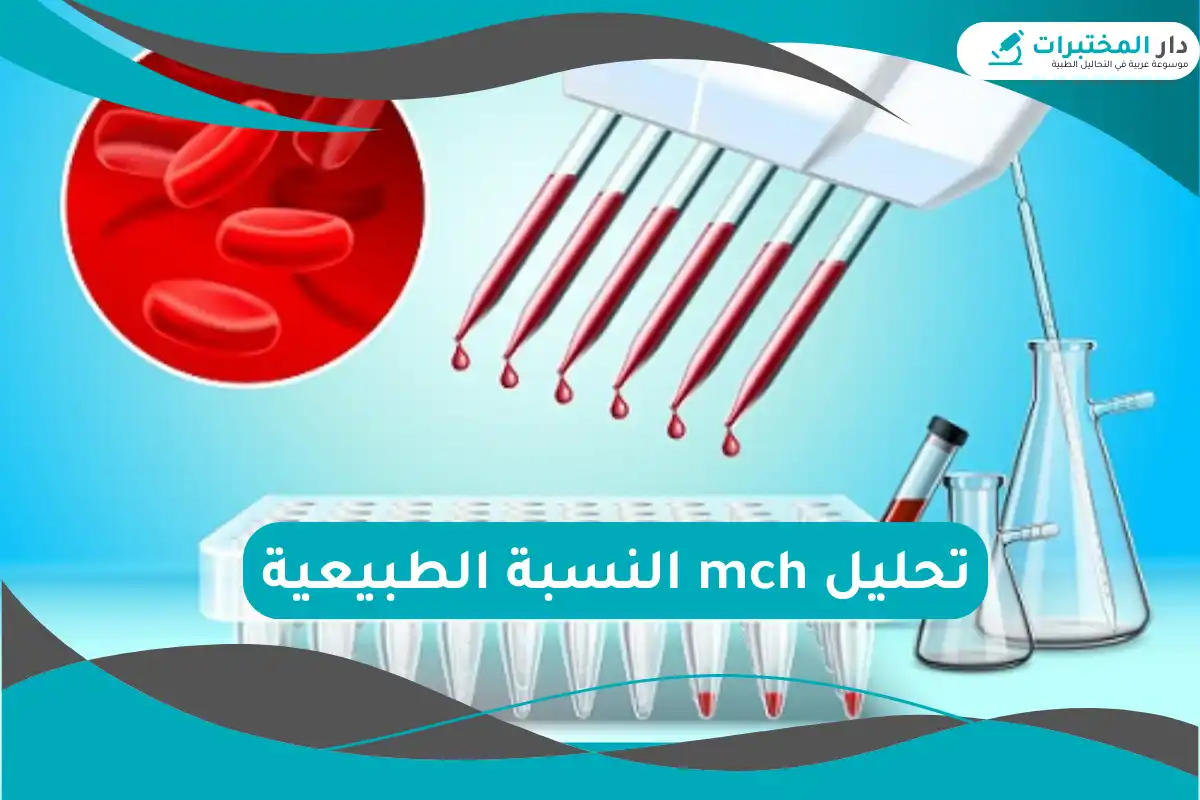 تحليل mch النسبة الطبيعية