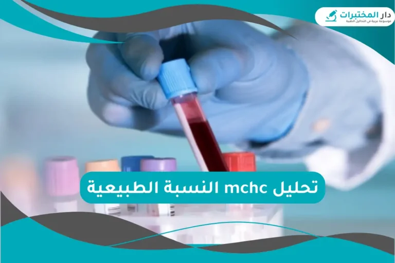 تحليل mchc النسبة الطبيعية