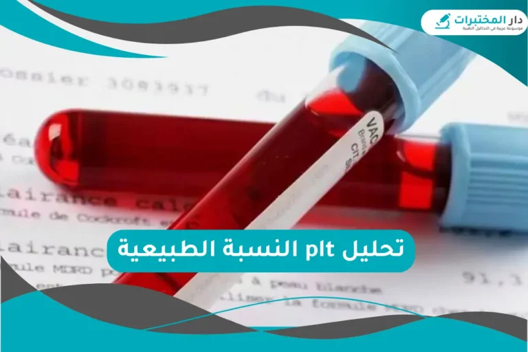 تحليل plt النسبة الطبيعية