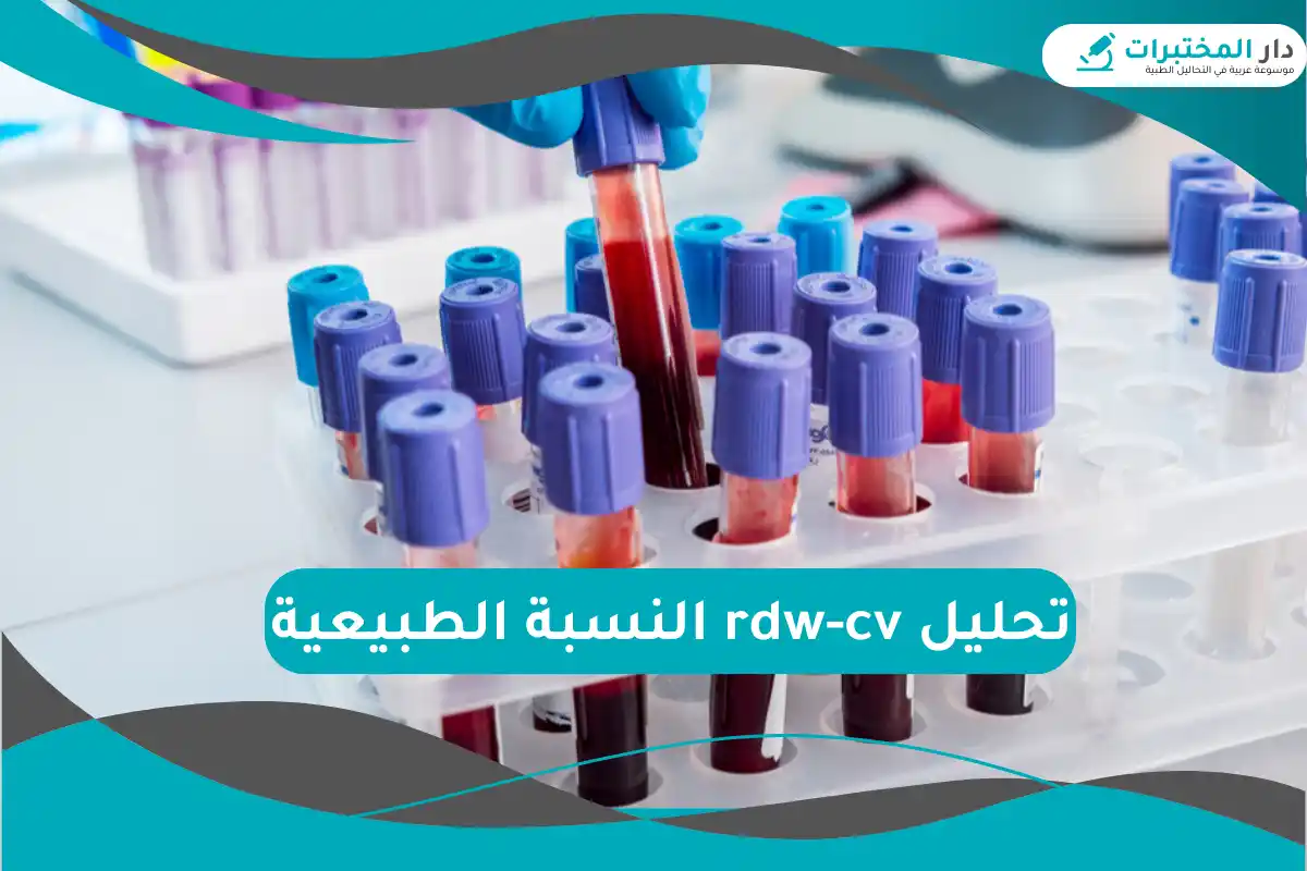 تحليل rdw-cv النسبة الطبيعية