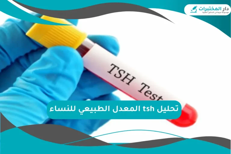 تحليل tsh المعدل الطبيعي للنساء