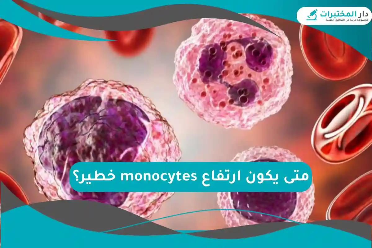 متى يكون ارتفاع monocytes خطير؟