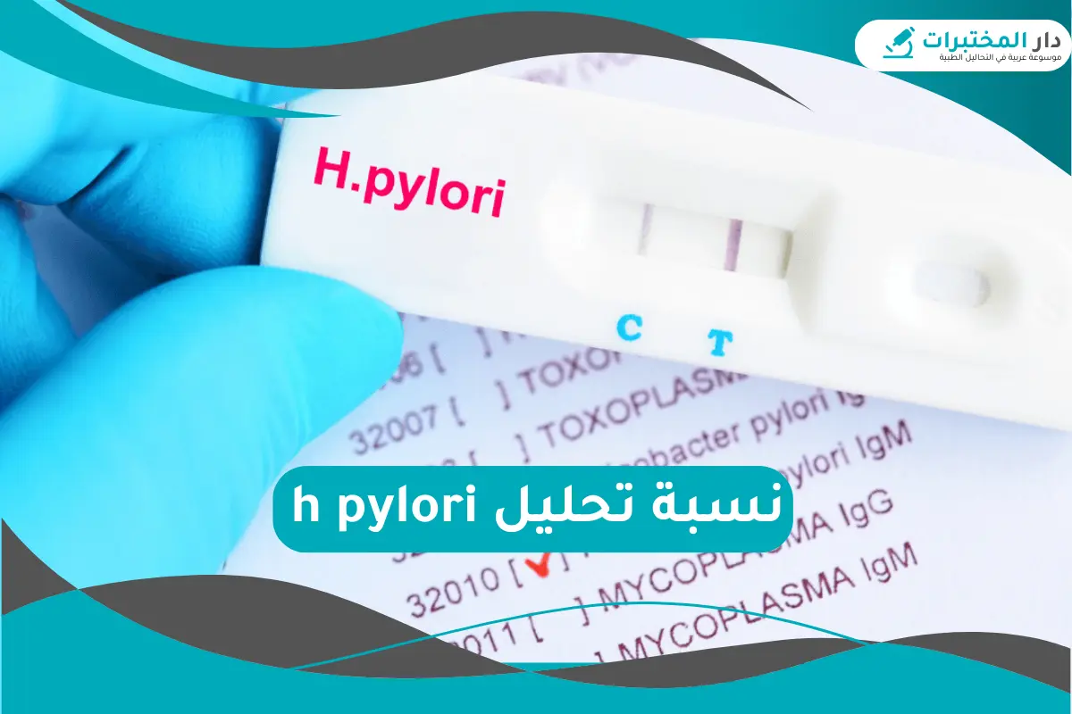 نسبة تحليل h pylori