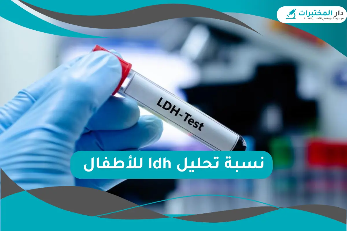 نسبة تحليل ldh للأطفال 